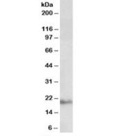 Western blot testing of human kidney lysate with Dynactin 3 antibody at 0.03ug/ml. Expected molecular weight (human): ~22kDa.
