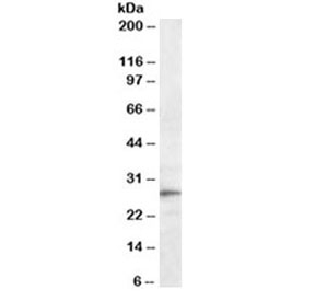 Western blot testing of mouse liver lysate with Trem2 antibody at 0.3ug/ml. Predicted molecular weight ~25kDa.~