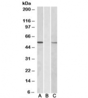 Western blot of HEK293 lysate overexpressing human MGAT1-MYC probed with MGAT1 antibody [1ug/ml] in Lane A and anti-MYC [1/1000] in lane C. Mock-transfected HEK293 probed with MGAT1 antibody [1ug/ml] in Lane B. Predicted molecular weight: ~51kDa.