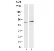 Western blot testing of 1) mouse ovary (Ab at 0.1ug/ml) and 2) rat ovary (Ab at 2ug/ml) lysates with Vimentin antibody. Predicted molecular weight ~54 kDa.