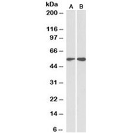 Western blot testing of HeLa [A] and Jurkat [B] lysates with Vimentin antibody at 2ug/ml. Predicted molecular weight ~54kDa.~