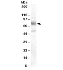 Western blot testing of A431 cell lysate with DCP1A antibody at 2ug/ml. Predicted molecular weight: ~63kDa, observed here at ~75kDa.