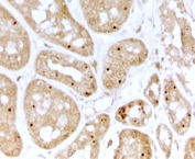 IHC testing of FFPE human kidney with NOLC1 antibody at 2ug/ml. HIER: steamed with pH6 citrate buffer, HRP-staining. Nucleolar staining in convoluted tubules is seen.