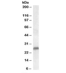 Western blot testing of human prostate lysate with SRD5A2 antibody at 0.3ug/ml. Predicted molecular weight: ~28kDa.