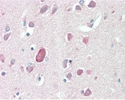 IHC testing of FFPE human brain (cortex) tissue with PTGDS antibody at 5ug/ml. Required HIER: steamed antigen retrieval with pH6 citrate buffer; AP-staining.