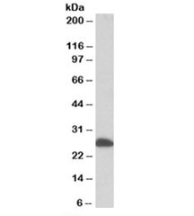 Western blot testing of human liver lysate with ETFB antibody at 0.1ug/ml. Predicted molecular weight: ~28kDa.~