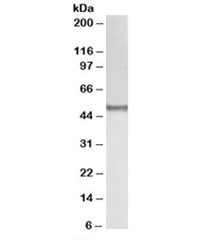 Western blot testing of human thymus lysate with BLK antibody at 0.1ug/ml. Predicted molecular weight: ~58kDa, routinely observed at ~55kDa.