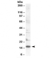 Western blot testing of human lymph node lysate with SH2D1 antibody at 0.2ug/ml. Predicted molecular weight: ~14kDa.