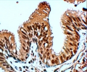 IHC testing of FFPE human lung with FBXL12 antibody at 4ug/ml. HIER: steamed with pH6 citrate buffer, HRP-staining.