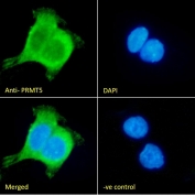 IF/ICC staining of fixed and permeabilized human A431 cells with PRMT5 antibody (green) at 10ug/ml and DAPI nuclear stain (blue).
