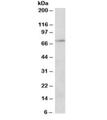 Western blot testing of Jurkat lysate with PRMT5 antibody at 2ug/ml. Expected molecular weight ~72kDa.