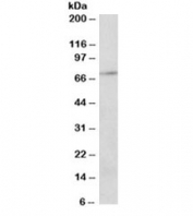 Western blot testing of Jurkat lysate with PRMT5 antibody at 2ug/ml. Expected molecular weight ~72kDa.