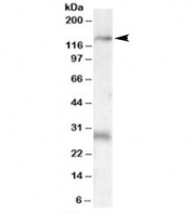 Western blot testing of rat heart lysate with MAP3K6 antibody at 0.3ug/ml. The expected ~140kDa band and the additional ~28kDa band are both blocked by the immunizing peptide.