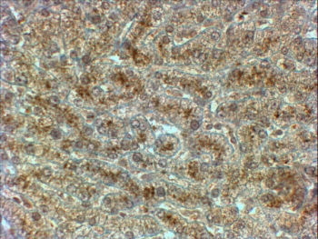IHC testing of FFPE human liver with SYVN1 antibody at 2ug/ml. HIER: steamed with pH6 citrate buffer, HRP-staining.