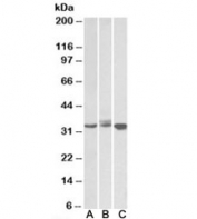 Western blot testing of Daudi (A), Jurkat (B) and K562 (C) lysates with Livin antibody at 0.5ug/ml. Predicted molecular weight: 33/30kDa (isoforms alpha/beta).