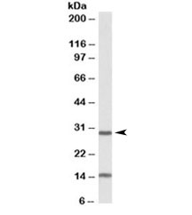 Western blot testing of mouse heart lysate with Sirt3 antibody at 0.3ug/ml. The expected ~28kDa band (processed form) and the additional ~15kDa band are both blocked by the immunizing peptide.