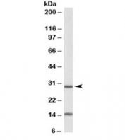 Western blot testing of mouse heart lysate with Sirt3 antibody at 0.3ug/ml. The expected ~28kDa band (processed form) and the additional ~15kDa band are both blocked by the immunizing peptide.