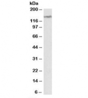 Western blot testing of human cerebellum lysate with LMTK2 antibody at 2ug/ml. Predicted molecular weight: ~165kDa, observed here at ~150kDa.