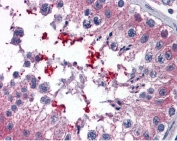 IHC testing of FFPE human testis tissue with ABCD4 antibody at 3.75ug/ml. Required HIER: steamed antigen retrieval with pH6 citrate buffer; AP-staining.