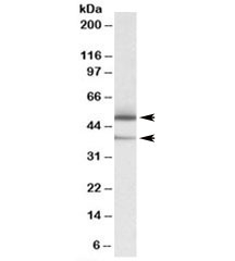 Western blot testing of human lymph node lysate with TXNDC5 antibody at 0.05ug/ml. Isoforms of ~48kDa and ~36kDa may be detected.~