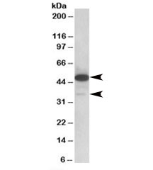 Western blot testing of human lymph node lysate with TXNDC5 antibody at 0.1ug/ml. Isoforms of ~48kDa and ~36kDa may be detected.~