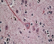 IHC staining of FFPE human brain with Synaptotagmin 1 antibody at 4ug/ml. HIER: steamed with pH6 citrate buffer, AP-staining.