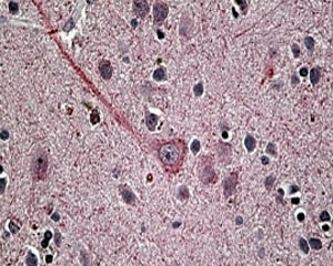 IHC staining of FFPE human brain with Synaptotagmin 1 antibody at 4ug/ml. HIER: