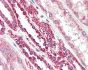 IHC staining of FFPE human kidney with TSPO antibody at 5ug/ml. HIER: steamed with pH6 citrate buffer, AP-staining.