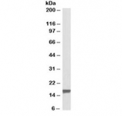 Western blot testing of human breast cancer lysate with TSPO antibody at 0.1ug/ml. Predicted molecular weight: ~19 kDa.