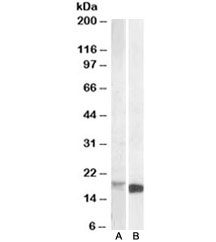 Western blot testing of mouse kidney lysate [A] and of mouse spleen lysate [B] with Pbr antibody at 1ug/ml. Predicted molecular weight: ~19kDa.