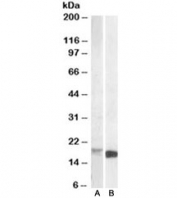 Western blot testing of mouse kidney lysate [A] and of mouse spleen lysate [B] with Pbr antibody at 1ug/ml. Predicted molecular weight: ~19 kDa.