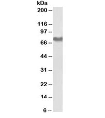 Western blot testing of human platelet lysate with Fibrinogen antibody at 0.01ug/ml. Predicted molecular weight ~70kDa.