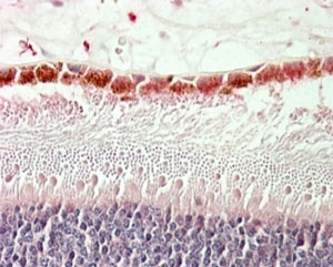 IHC staining of FFPE human retina with RDH5 antibody at 5ug/ml. HIER: steamed with pH6 citrate buffer, AP-staining. Staining of the ganglion cell layer is observed.~
