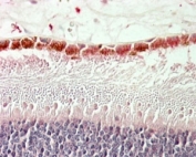 IHC staining of FFPE human retina with RDH5 antibody at 5ug/ml. HIER: steamed with pH6 citrate buffer, AP-staining. Staining of the ganglion cell layer is observed.