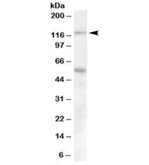 Western blot testing of human umbillical cord lysate with Palladin antibody at 0.1ug/ml. Predicted molecular weight: ~125kDa. Both observed bands are blocked by addition of immunizing peptide.