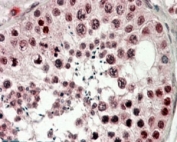 IHC staining of FFPE human testis with CIRBP antibody at 4ug/ml. HIER: steamed with pH6 citrate buffer, AP-staining.