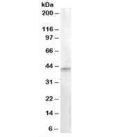 Western blot testing of human testis lysate with RASSF8 antibody at 0.3ug/ml. Predicted molecular weight: ~45kDa.