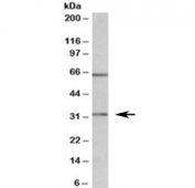 Western blot testing of MOLT4 lysate with Caspase 3 antibody at 1ug/ml. The expected ~32kDa band and the additional ~65kDa band are both blocked by the immunizing peptide.