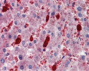 IHC testing of FFPE human liver tissue with CADM4 antibody at 2.5ug/ml. Required HIER: steamed antigen retrieval with pH6 citrate buffer; AP-staining.