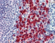 IHC testing of FFPE human spleen tissue with CADM4 antibody at 2.5ug/ml. Required HIER: steamed antigen retrieval with pH6 citrate buffer; AP-staining.