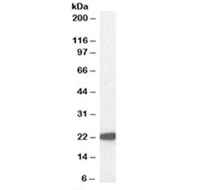 Western blot testing of human liver lysate with GPX antibody at 1ug/ml. Predicted molecular weight ~22kDa.