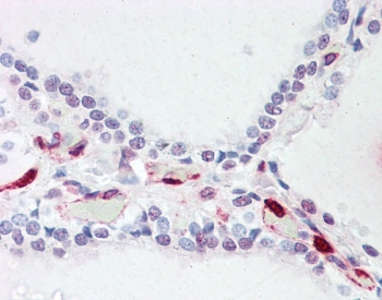 IHC testing of FFPE human thyroid with ATP13A1 antibody at 5ug/ml. Required HIER: steamed anti