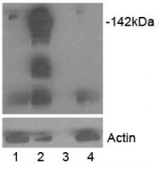Western blot of HEK293 lysate overexpressing TANK1/Tankyrase (lane 2) and TANK2 (lane 4) tested with Tankyrase antibody at 0.5ug/ml. Mock transfection is in lane 1 and lane 3 is empty. Lower panel shows the same lysates tested for alpha-Actin (loading control).