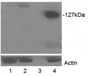 Western blot testing of transfected HEK293 lysate with Tankyrase 2 antibody at 0.5ug/ml. Lane 1: mock TANK2; Lane 2: TANK1; Lane 3: empty; Lane 4: TANK2. Lower panel shows the same lysates probed for Actin (loading control).