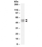 Western blot testing of human bone marrow lysate with THRB antibody at 0.3ug/ml. Predicted molecular weight: ~52/55kDa (isoforms 1/2).