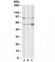 Western blot testing of mouse [A], rat [B] and pig [C] heart lysate with ADAM12 antibody at 0.1ug/ml. Predicted molecular weight: ~99/80kDa (long/short form), but observed at ~90/68kDa.
