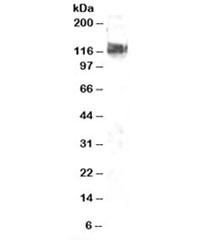 Western blot testing of NIH3T3 lysate with CBL antibody at 2ug/ml. Predicted molecular weight: ~100kDa.