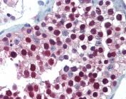 IHC testing of FFPE human testis tissue with FOXP2 antibody at 5ug/ml. Required HIER: steamed antigen retrieval with pH6 citrate buffer; AP-staining.