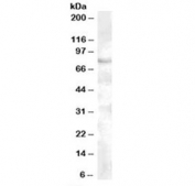 Western blot testing of human cerebellum lysate with FOXP2 antibody at 0.5ug/ml. Predicted molecular weight: ~80 kDa.