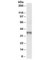 Western blot testing of human thymus lysate with MAT2B antibody at 0.3ug/ml. Predicted molecular weight: ~37kDa.